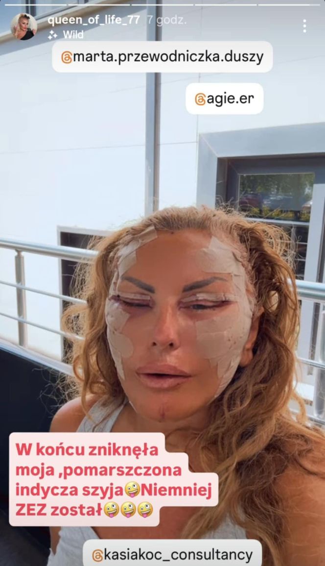 Dagmara Kaźmierska po operacji twarzy