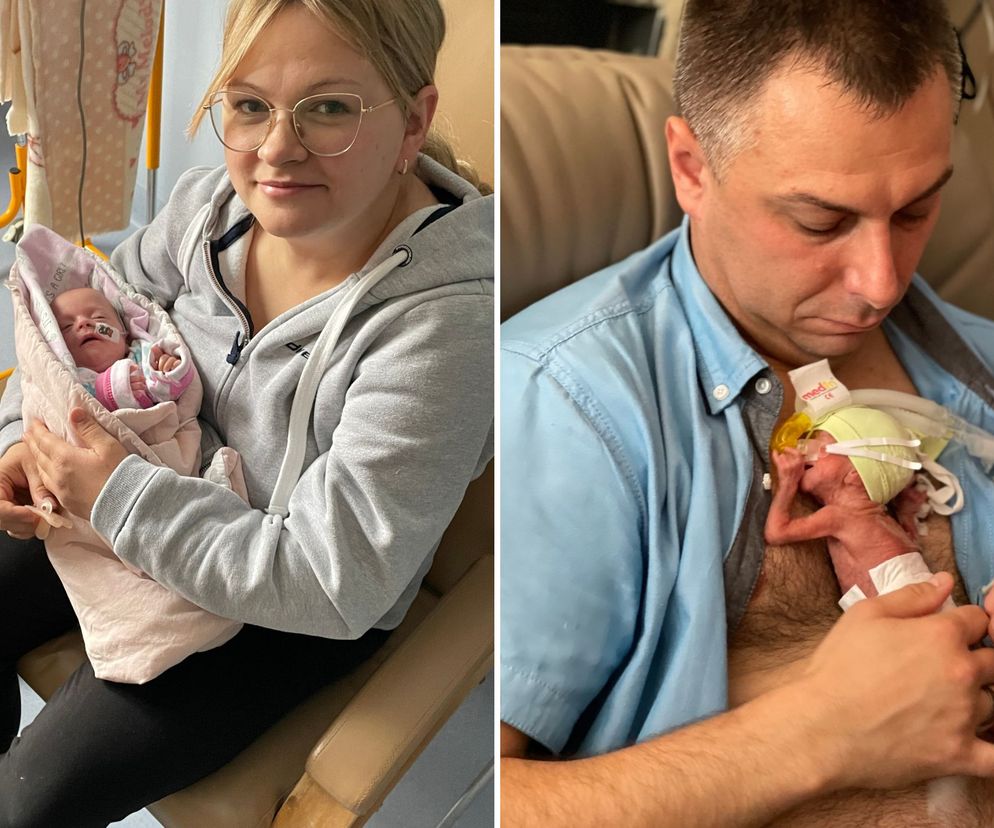 Ewenement wśród pacjentów. Gdy przyszła na świat ważyła zaledwie… 390 gramów