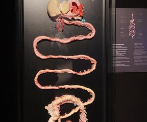 Wystawa z ludzkiego ciała. Body Worlds powróciła do Gdańska po 5 latach 