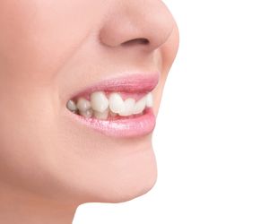 Wady zgryzu: rodzaje, przyczyny, korekcja