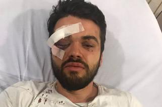Rugbysta-gej brutalnie pobity. Wylądował w szpitalu [ZDJĘCIE]