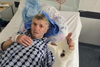 Palec czy papierosy? Emeryt podjął dramatyczną decyzję. Dziś ma i kciuka i nowe życie