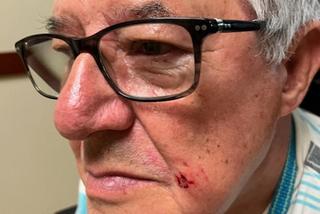 Były szef ZKP pogryziony przez trzy psy