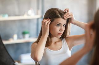 Pryszcze na głowie: jak wyleczyć trądzik we włosach?