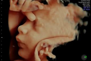 Badanie USG w ciąży - co to jest USG 3D i 4D?