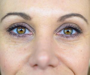 Zmarszczki na twarzy - jak powstają? Typy zmarszczek i ich występowanie