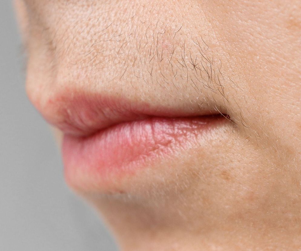 Wąsik zniknie bez śladu! Wystarczy 20 minut i 3 składniki, które masz w kuchni