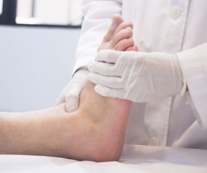 Stopa - budowa, funkcje, choroby