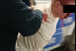 Przedłużony areszt dla zbójcy ratownika