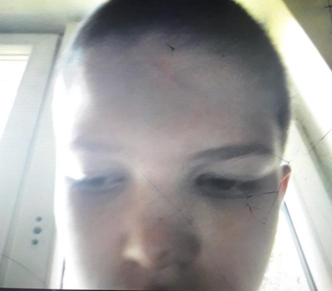 ZAGINAL 12 LETNI DANIEL