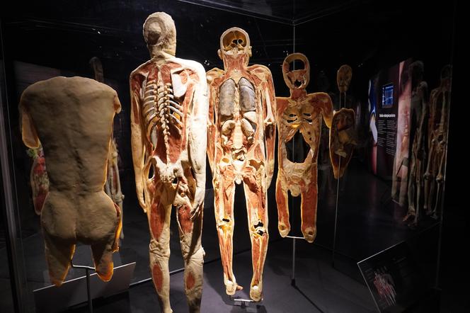 Wystawa z ludzkiego ciała. Body Worlds powróciła do Gdańska po 5 latach 