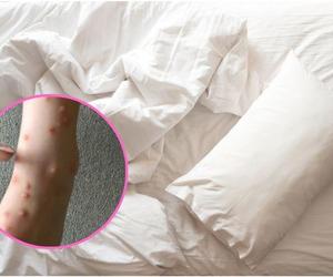 Wakacje zmieniły się w koszmar. W hotelowym pokoju były ich tysiące