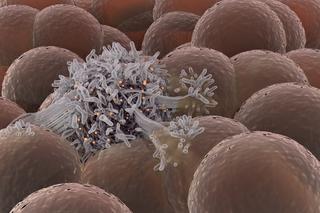 Co wiesz o raku? Narodowy Test Wiedzy o Walce z Rakiem