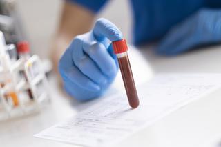Wystarczy kropla krwi, by przewidzieć 67 chorób? Sekret tkwi w niewielkiej cząsteczce