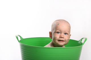Ospa u niemowlaka: jak pielęgnować niemowlę chore na ospę wietrzną?