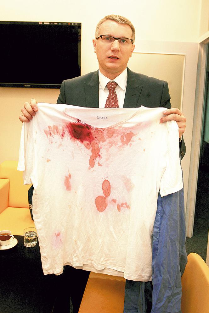 Wściekli policjanci skatowali Wiplera