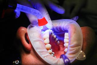 Japończycy pracują nad lekiem na odrost zębów. Były badania na myszach, teraz będą na ludziach