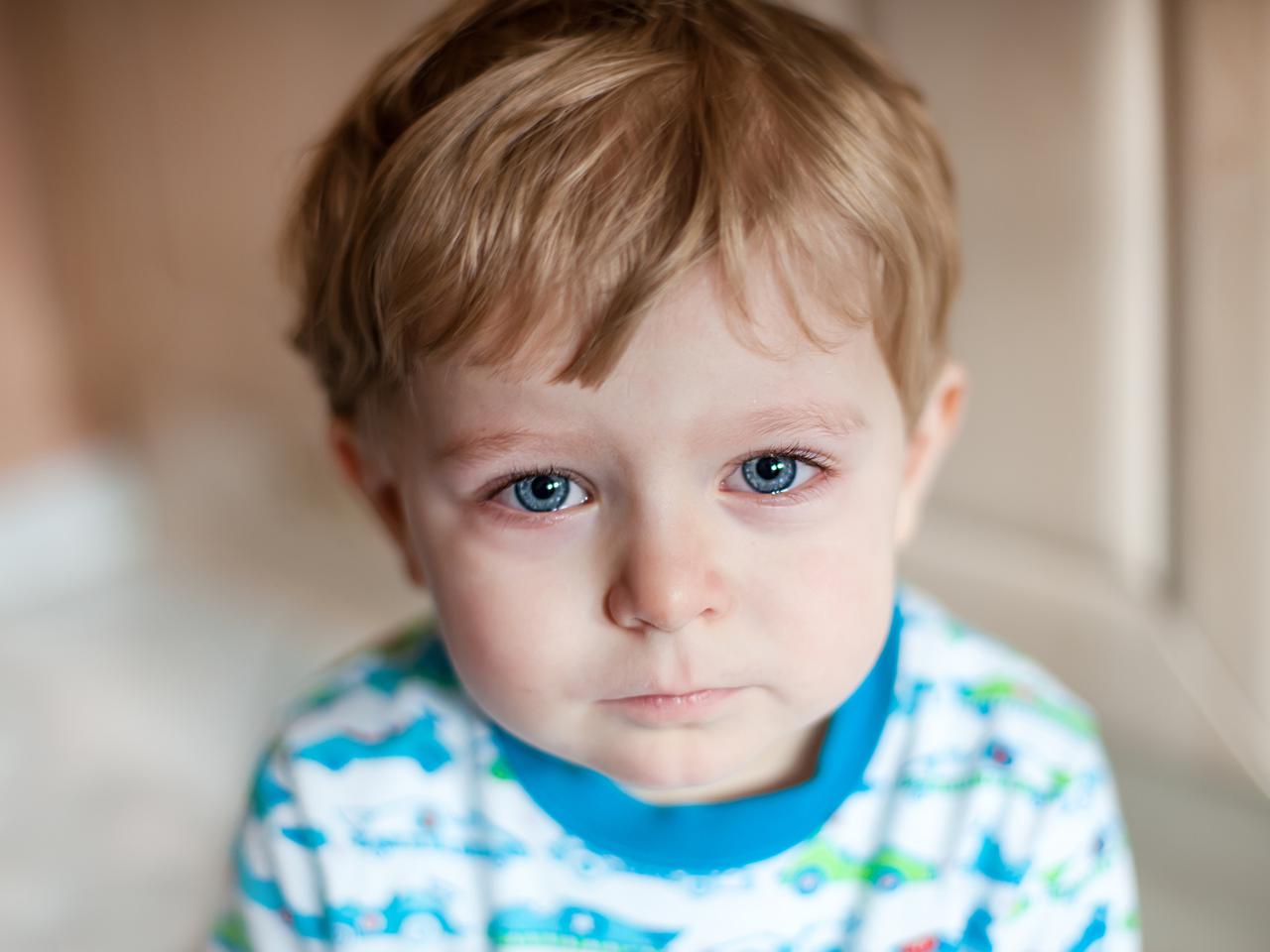 Plamica Schönleina-Henocha czyli zapalenie naczyń związane z przeciwciałami IgA u dzieci