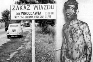 59 lat temu wybuchła epidemia czarnej ospy we Wrocławiu. Wywozili ludzi i nie wiadomo było, kiedy wrócą