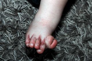 Moja syrenka odzyskała paluszki