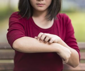 Osutka polekowa - jak leczyć? Rodzaje osutek polekowych