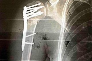 Aleksandra Rogowska-Lichnerowicz