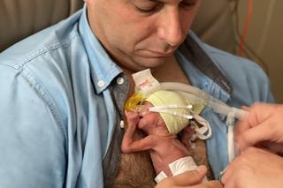 Marta ważyła 390 gramów po porodzie! 