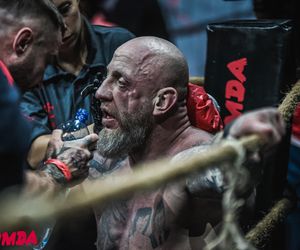 Łukasz GOAT Parobiec pokazał twarz po wojnie z Kubiszynem. Aż odwracaliśmy wzrok. Spójrzcie na jego nos