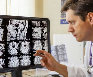Niedoczynność przysadki mózgowej - przyczyny, objawy i leczenie