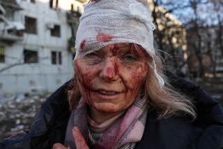 Jej zdjęcie stało się symbolem cierpienia cywili. Co dziś dzieje się z Oleną Kuryło?