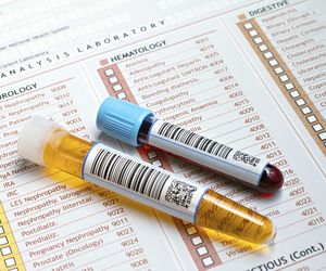 Profil nerkowy – badania oceniające pracę nerek