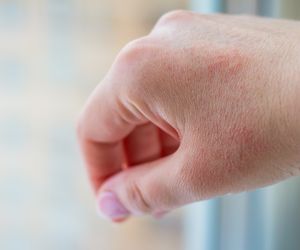 Czy możesz mieć uczulenie na zimno? Oto najczęstsze objawy