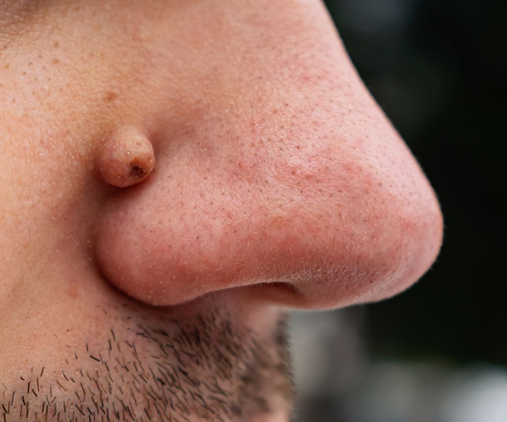 Zbliżenie na nos mężczyzny 
