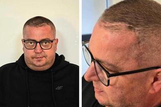 Dariusz walczy z wielkim guzem. Prosimy wszystkich o pomoc