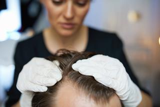 Jak wygląda wizyta u trychologa? Diagnostyka i leczenie skóry głowy oraz włosów
