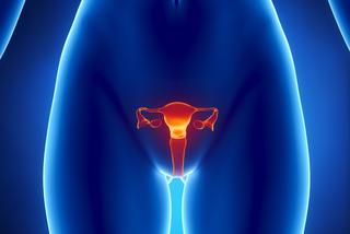 Jądrzak – nowotwór jajnika – prowadzi do pojawienia się męskich cech u kobiety