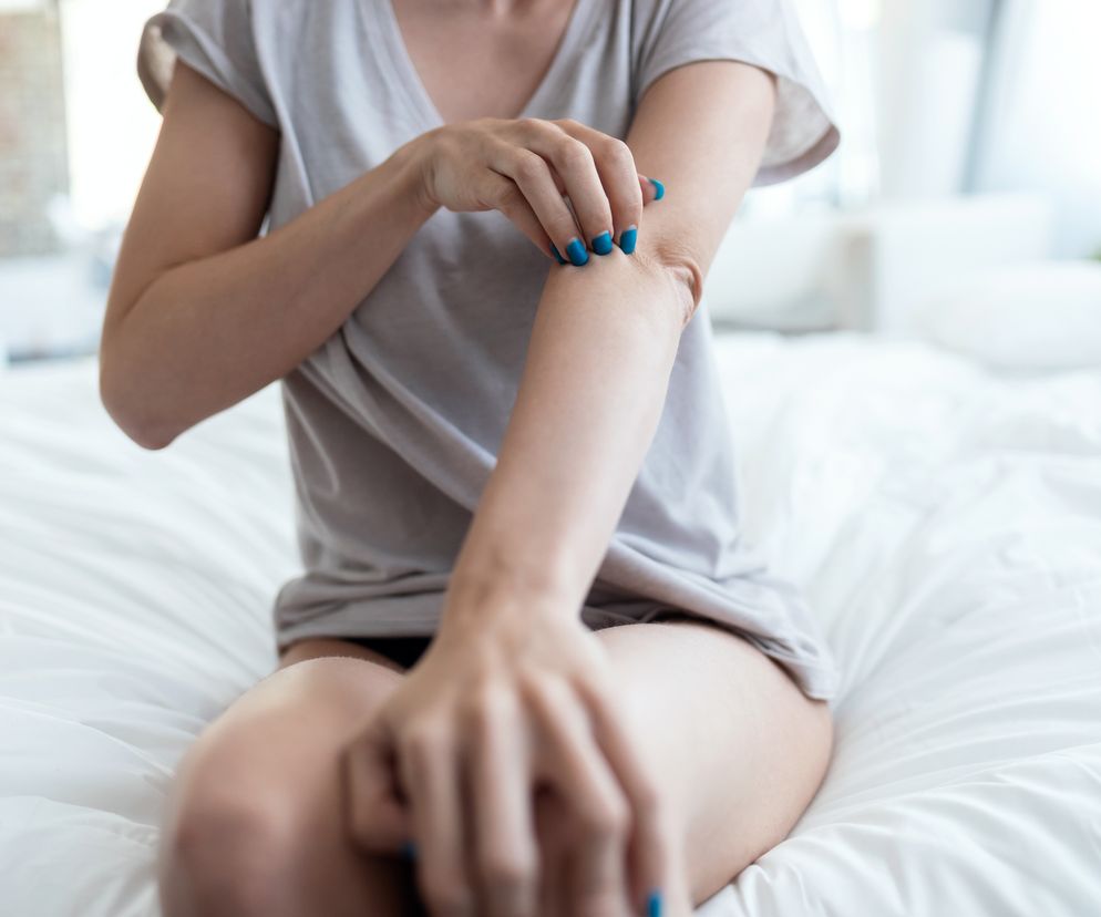 Zmiany skórne w chorobach trzustki