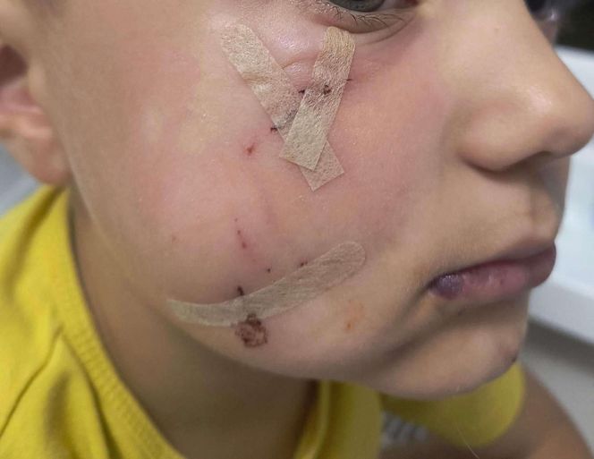 Pogryziony Franek potrzebuje pomocy. Policja szuka właściciela psa. Do szpitala dotarła anonimowa wiadomość