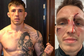 Zmasakrowana twarz Rhysa McKee po walce na Cage Warriors
