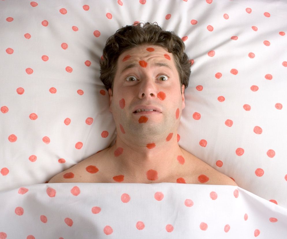 Różyczka przyczyną bezpłodności mężczyzn?  
 Które choroby wieku dziecięcego powodują  
 niepłodność mężczyzn?