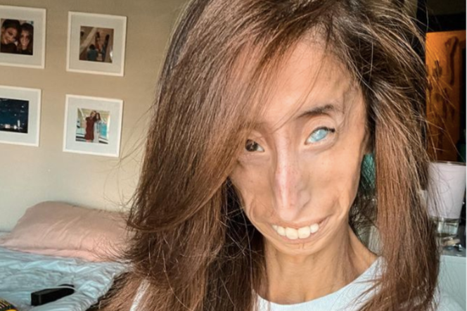 Lizzie Velásquez / Instagram