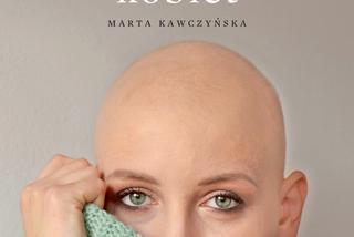 Poruszające historie: „Alopecjanki. Historie łysych kobiet” reportaż Marty Kawczyńskiej