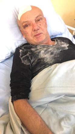 Pan Andrzej w brudnej koszuli. - To taki design - miała powiedzieć pielęgniarka