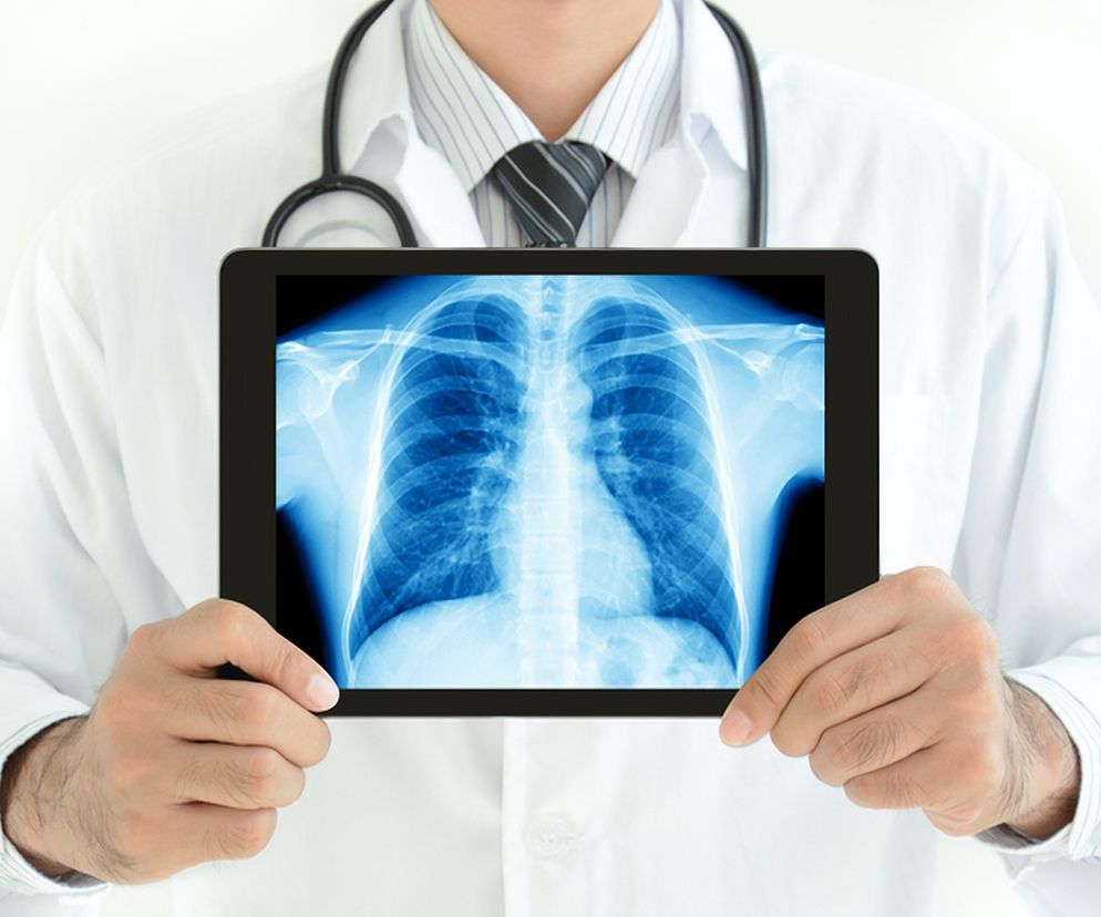 Żebra – budowa, funkcje, choroby