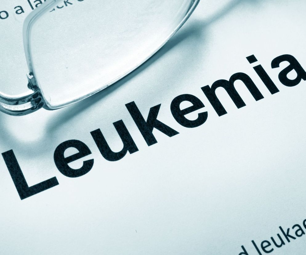 Białaczka włochatokomórkowa (hairy cell leukemia - HCL) to rzadka odmiana przewlekłej białaczki limfocytowej.