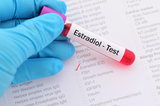 Estradiol: jak ten ważny hormon żeński wpływa na organizm kobiety?