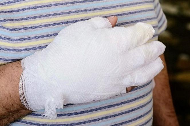 Sklepikarz bohater gołymi rękami wyniósł płonacą butlę gazową