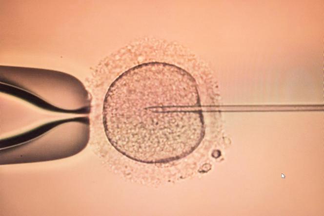 Rządowy program in vitro. W tych miastach wykonasz zabieg za darmo.