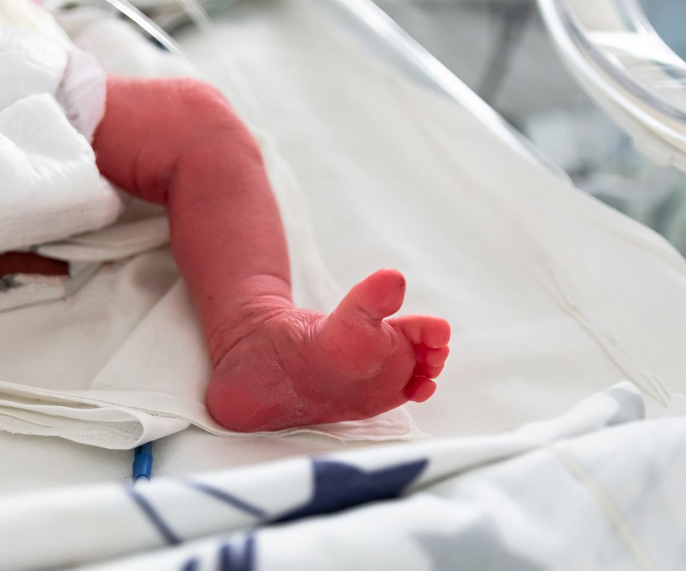 Na świat przyszło dziecko z trzema rękami. Dodatkowa kończyna wyrosła na plecach