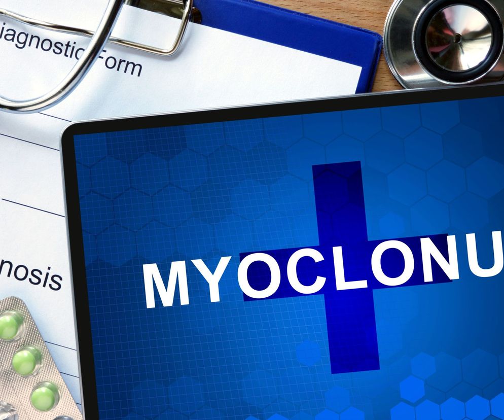 Mioklonie to gwałtowne i nagłe skurcze poszczególnych grup mięśniowych.  Występują nieregularnie, przeważnie w mięśniach kończyn.